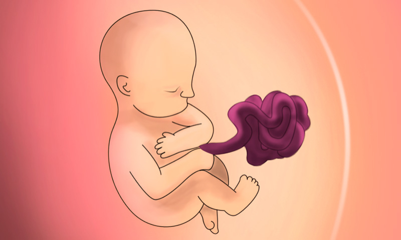 Gastrosquisis Fetal: ¿Qué es y cómo se detecta?